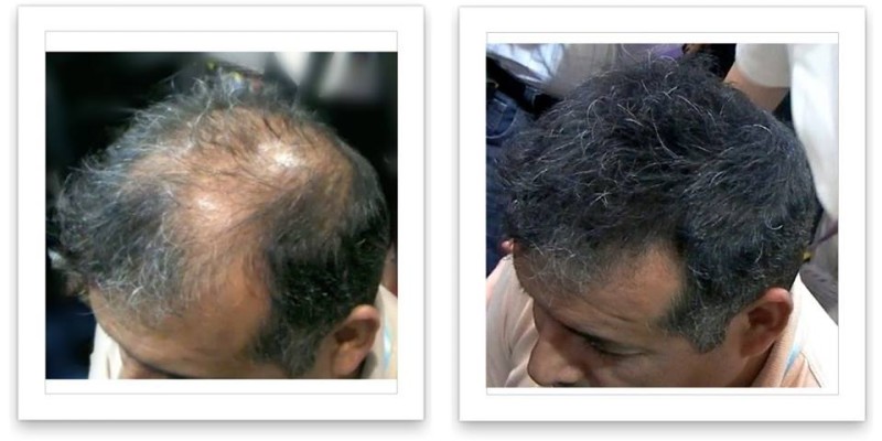 Caboki Hair Fiber Hair concealer in Karachi image 18