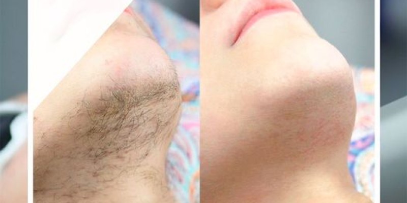 20% Discount at Defence Skin Clinic With Alied Bank 3 