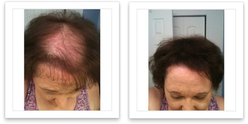 Caboki Hair Fiber Hair concealer in Karachi image 5