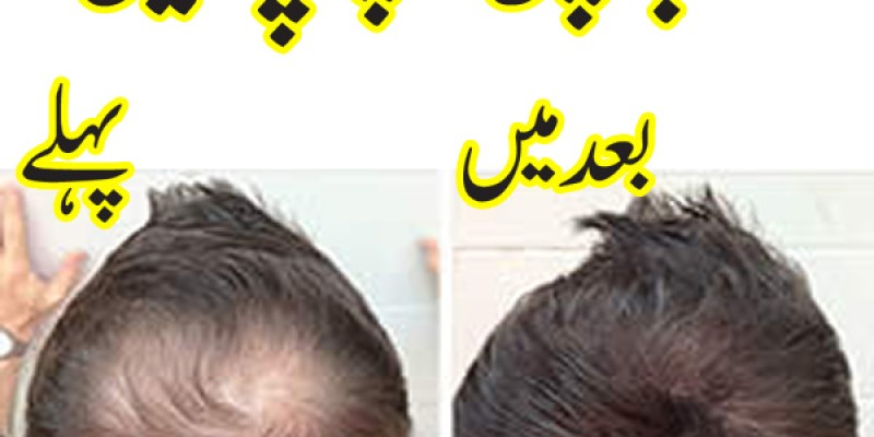 Caboki Hair Fiber Hair concealer in Karachi image 6