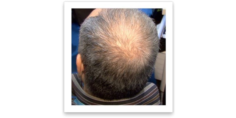 Caboki Hair Fiber Hair concealer in Karachi image 8