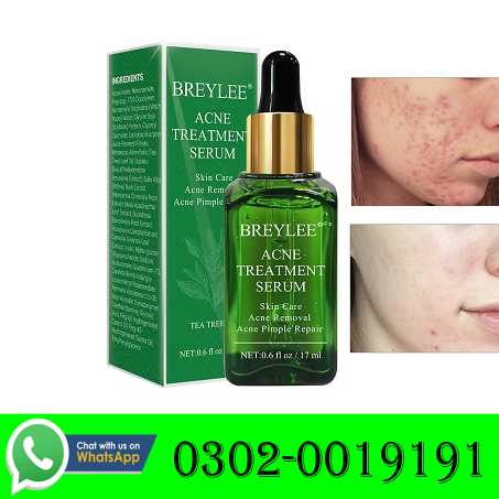 New Acne Treatment Serum in Karachi - 03020019191