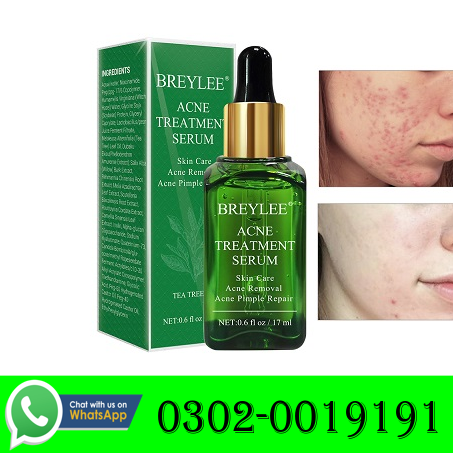 New Acne Treatment Serum in Peshawar - 03020019191